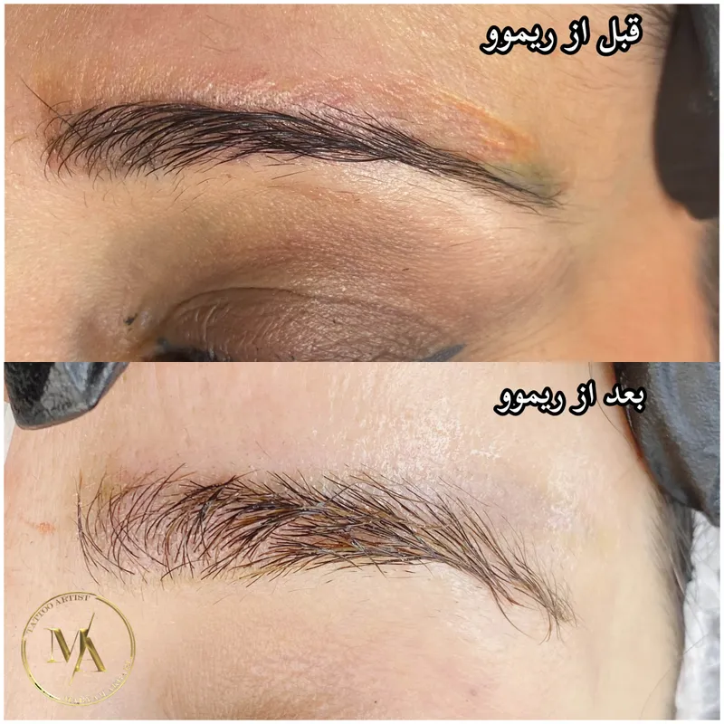 ریموو ابرو قرمز