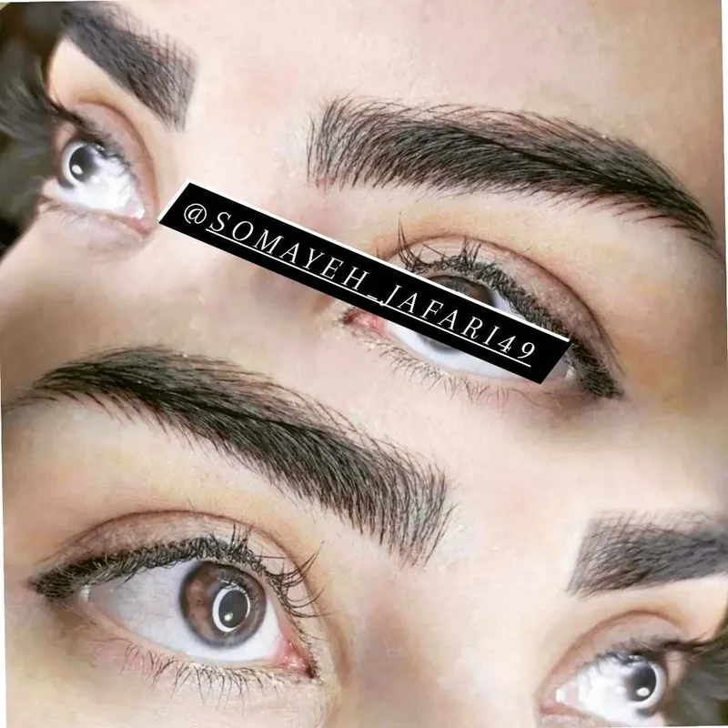 میکروبلیدینگ