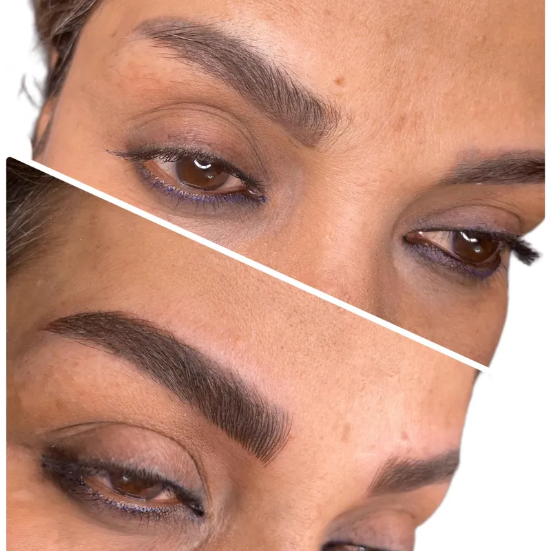 فیبروز و میکروبلیدینگ ابرو