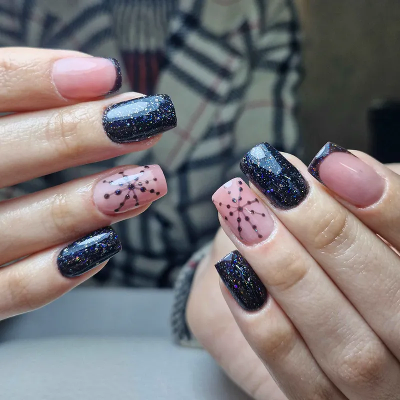 کاشت ژل