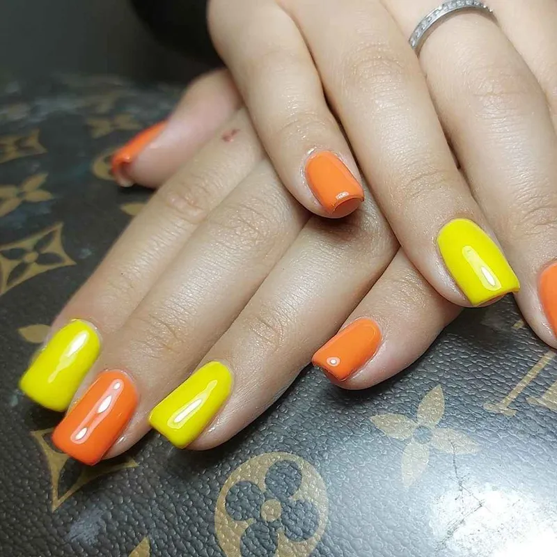 کاشت ژل