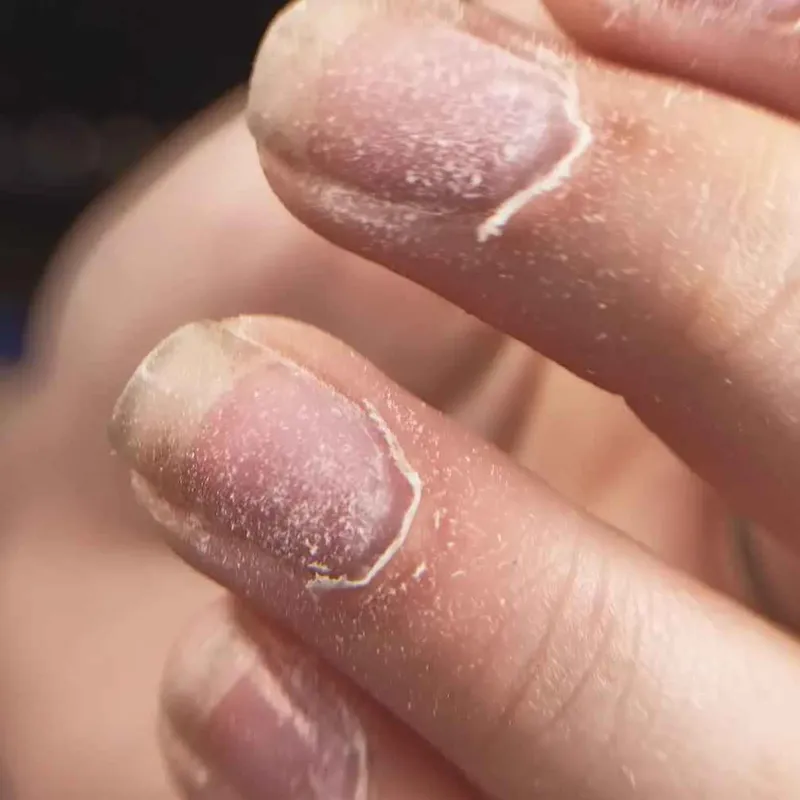 بستر سازی ناخن