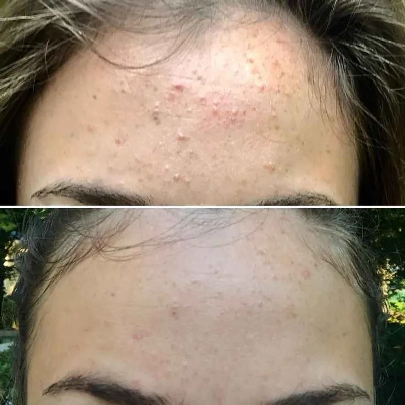 لایه برداری