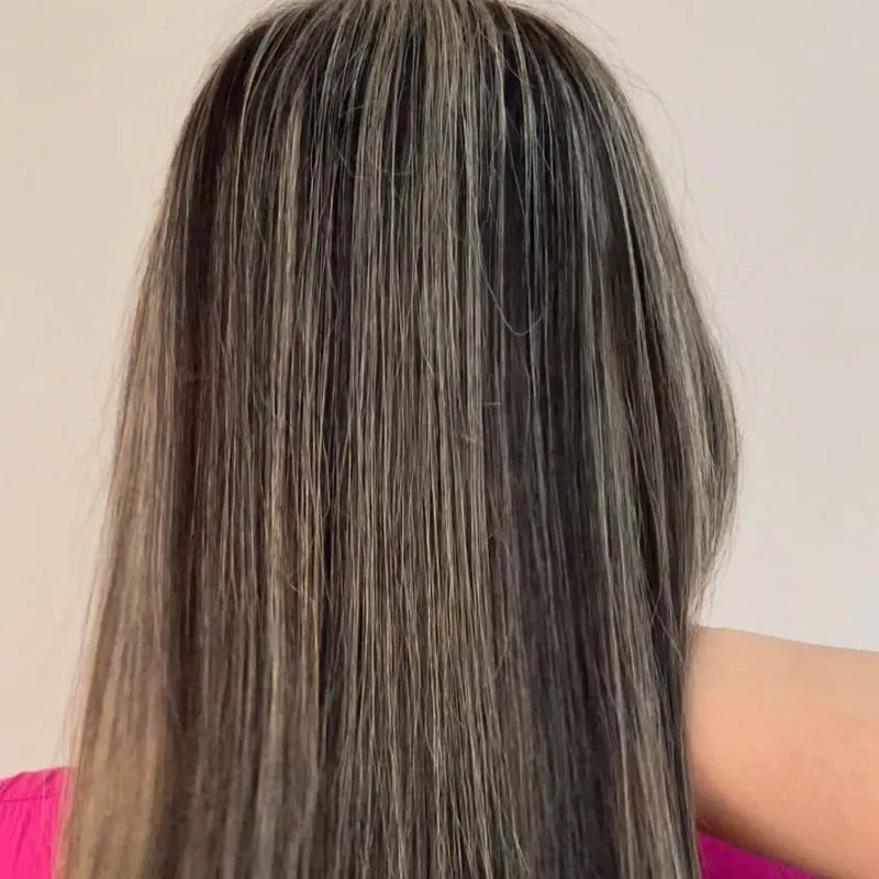 احیای موهای ۸۰٪ سوخته