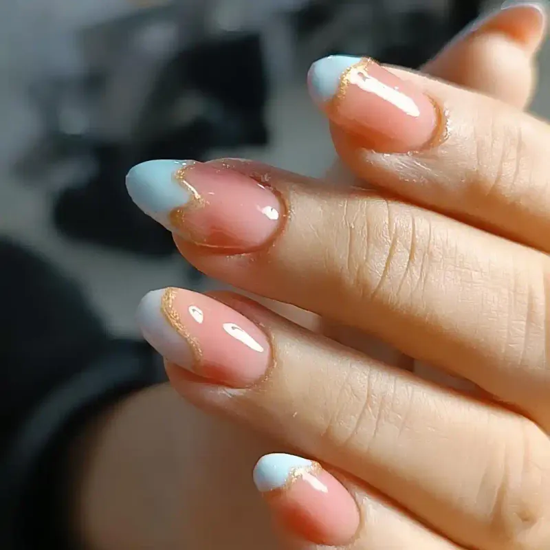 ترمیم ژل و متال ژل