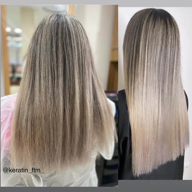 احیای موی دکلره 