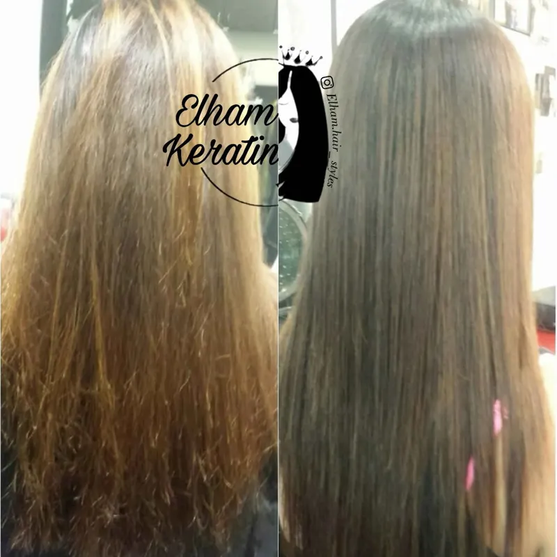 کراتینه سرعتی 