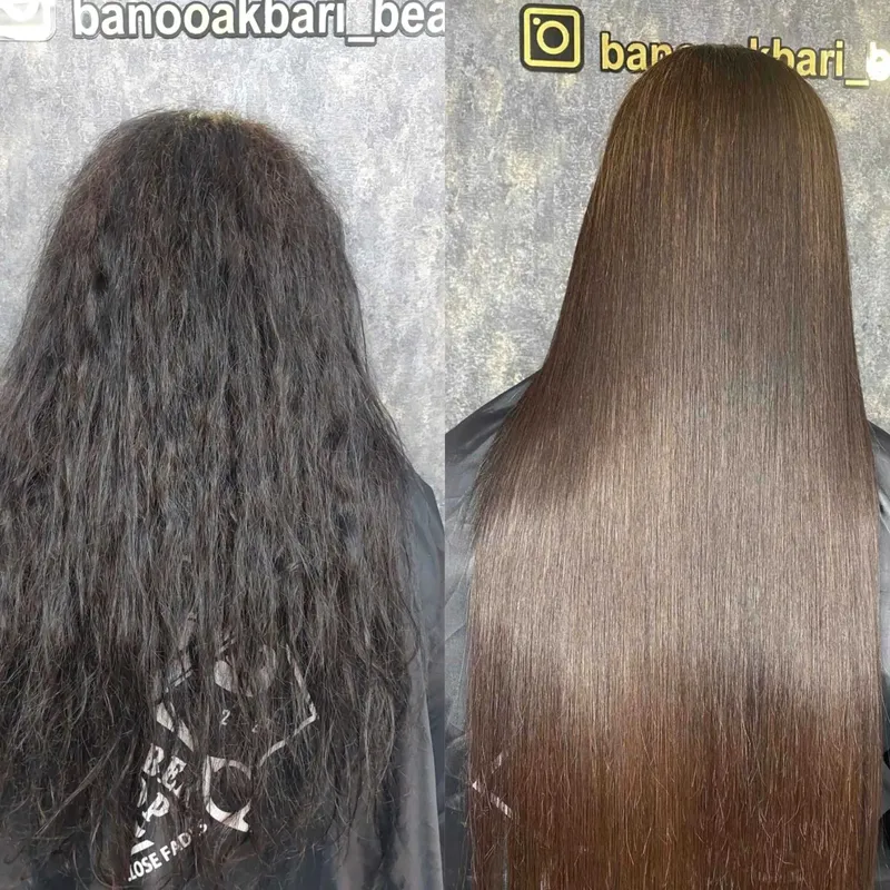 پروتئین تراپی 