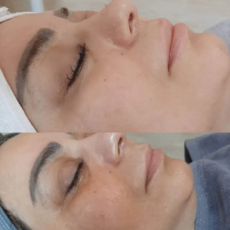 پاکسازی صورت