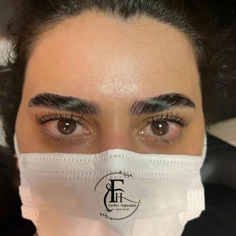 لیفت ابرو و مژه