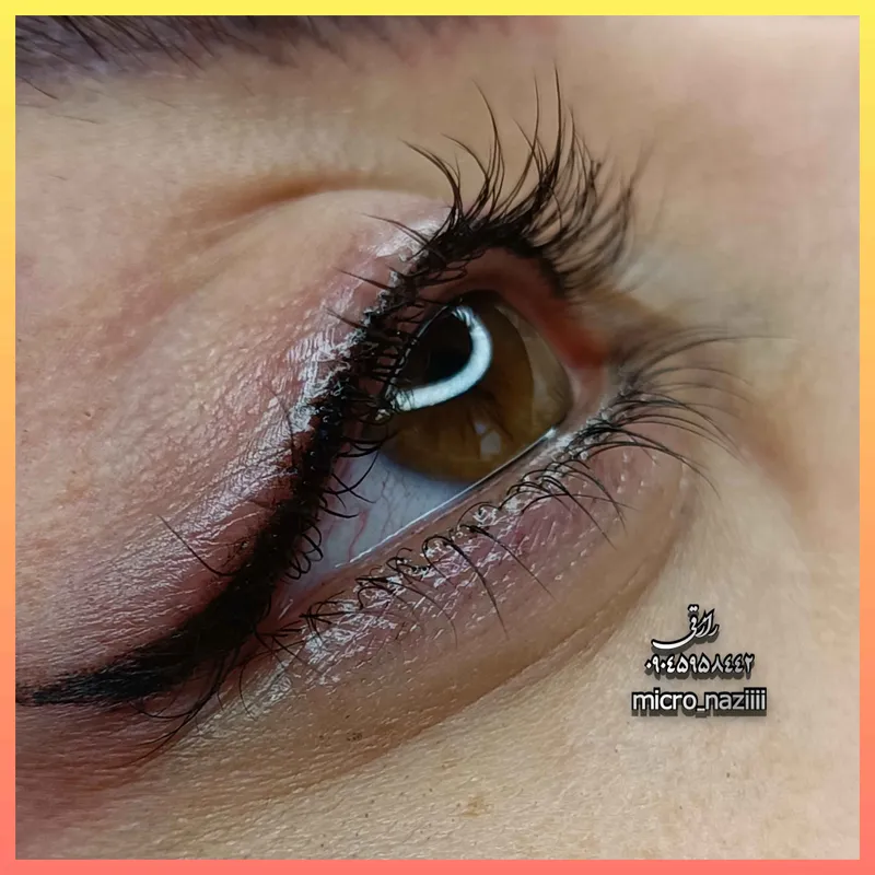 بن مژه مینیاتوری 