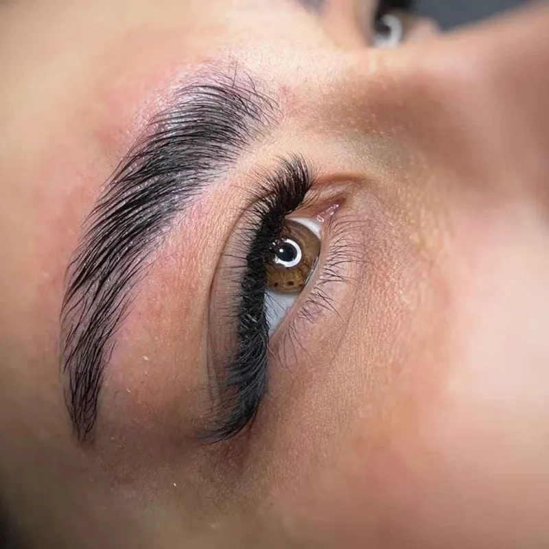 کاشت ۶۵۰ترمیم ۶۰۰