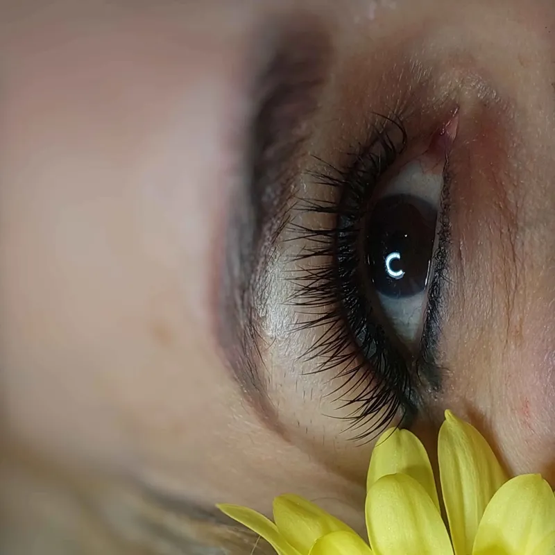 کاشت اولیه ۴۵۰ترمیم ۴۰۰