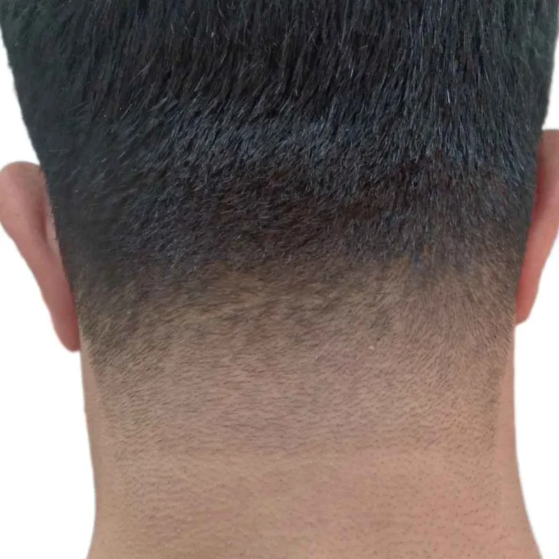 فید پشت گردن