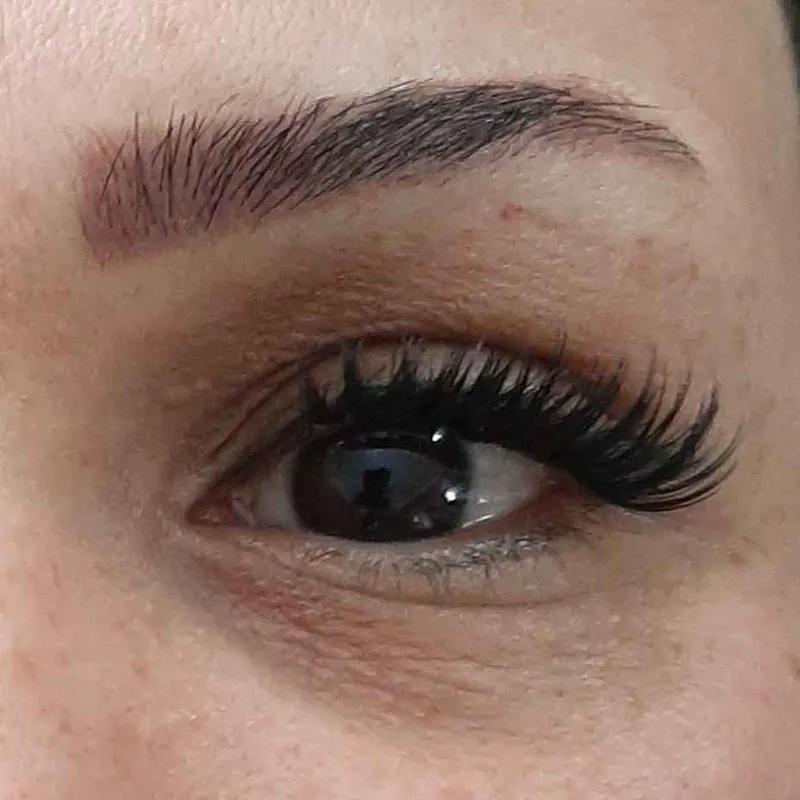 کاشت تک لاین