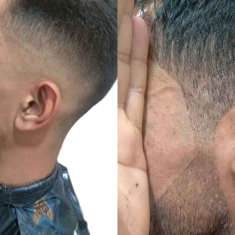 های فید    فید ریش