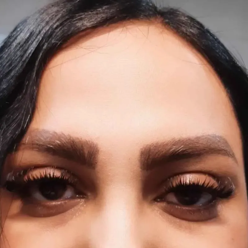 کاشت تک لاین