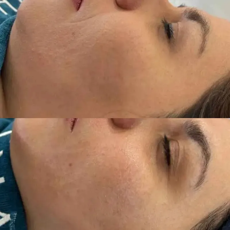 پاکسازی پوست