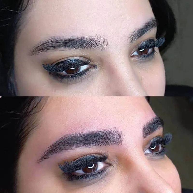 فیلرز خوشگل شیک و نچرال