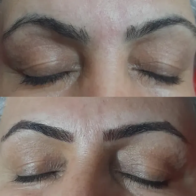 میکرو پیگمنتیشن