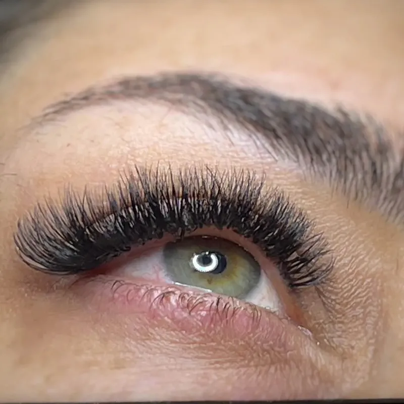 کاشت اولیه ۶۵۰ترمیم ۶۰۰