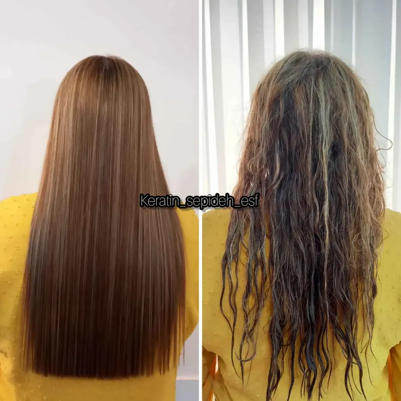 تکنیک آرژنین تراپی و نانو پروتئین