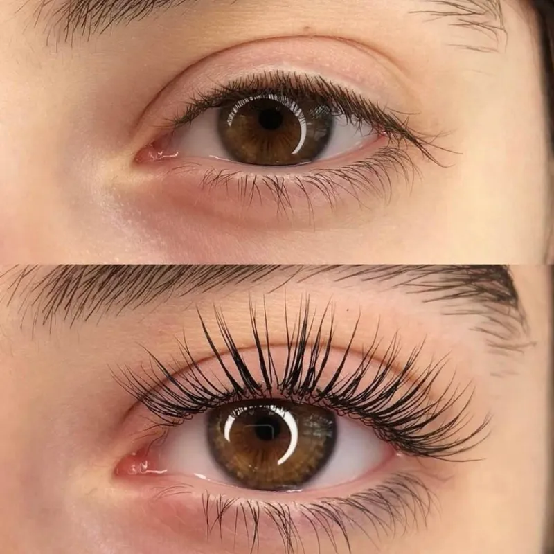 لیفت و لمینت