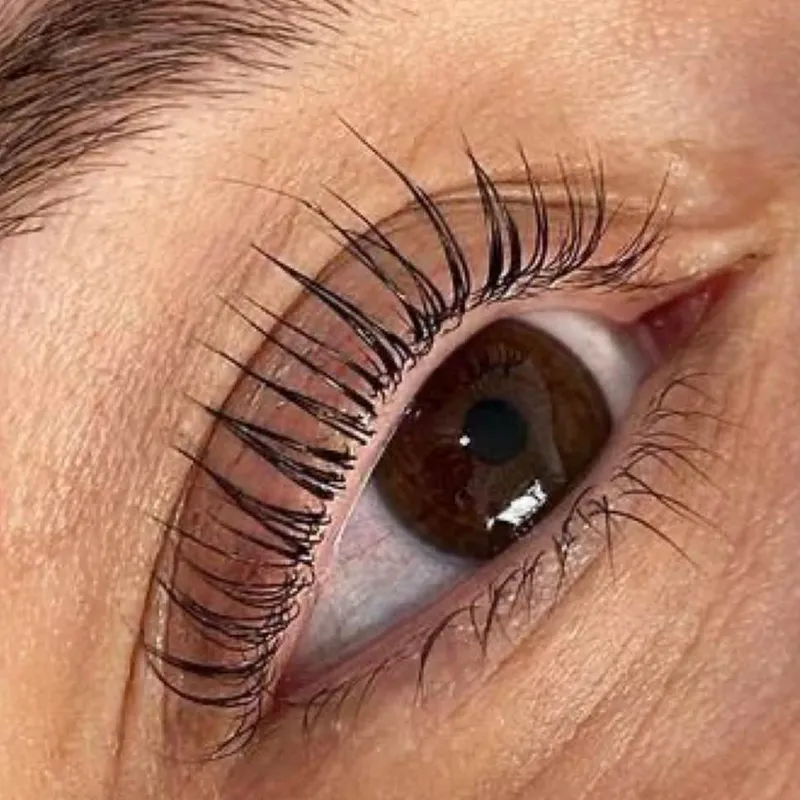 لیفت و لمینت