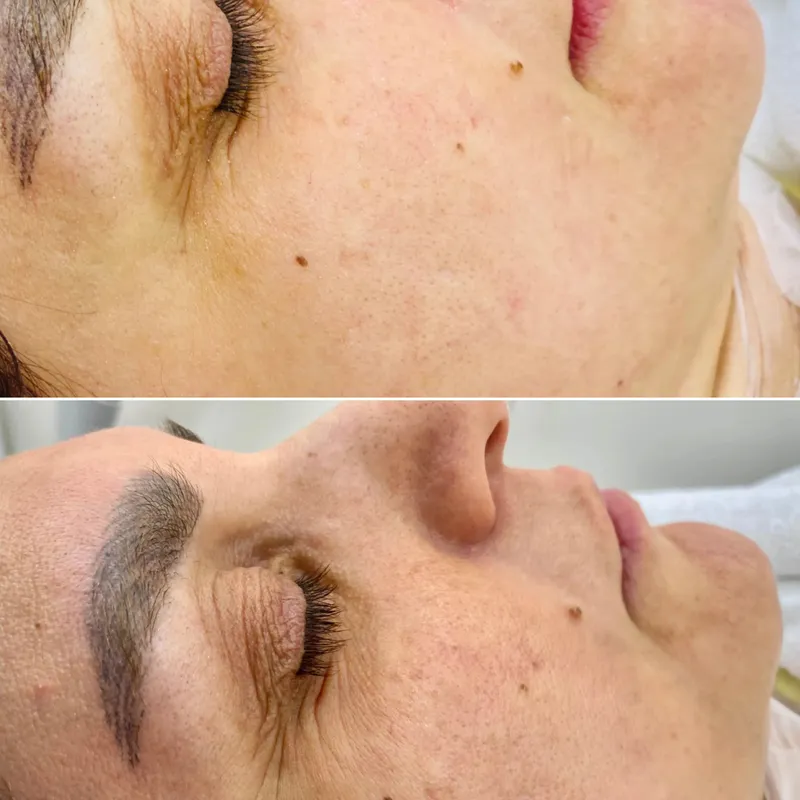 پاکسازی و آبرسانی تخصصی پوست خشک 