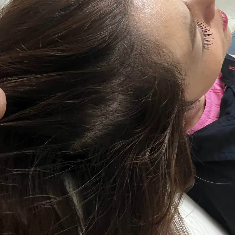 تو پر سازی مو 