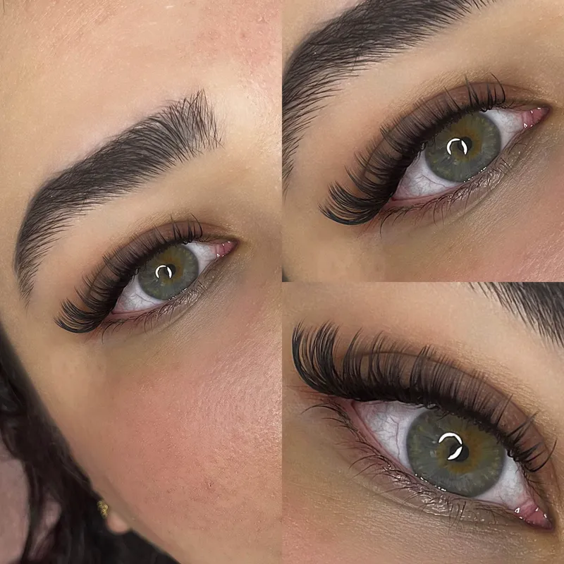 اسکتنشن اسپایکی