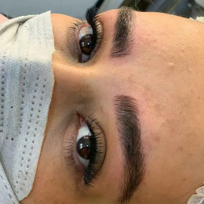 میکروبلیدینگ 