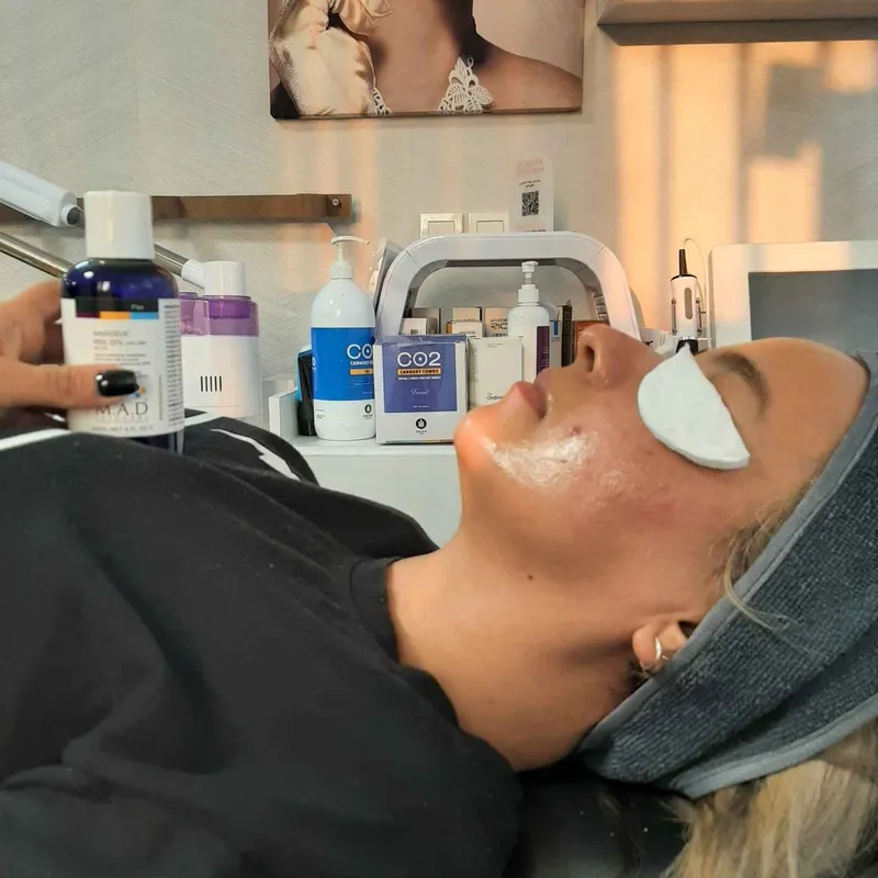 فیشال تخصصی؛ اسیدتراپی