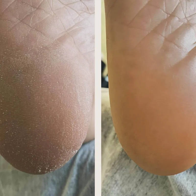 پدیکور کفسابی