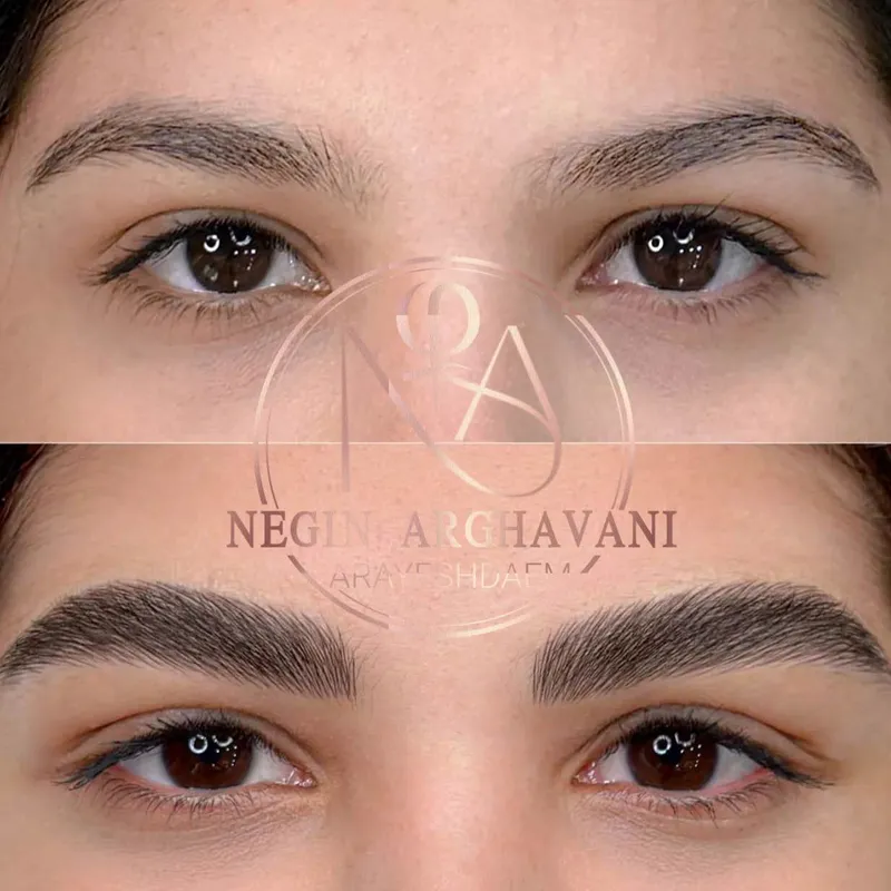 فیبروز ابرو