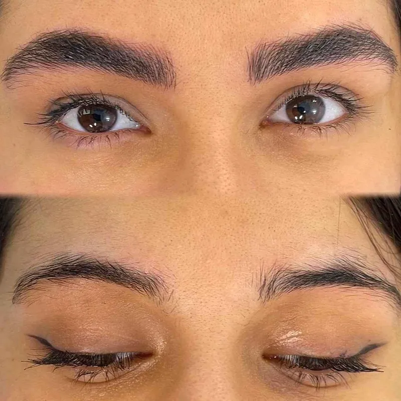 میکروبلیدینگ