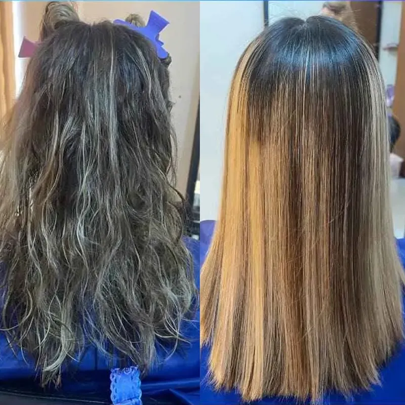 خاویار تراپی