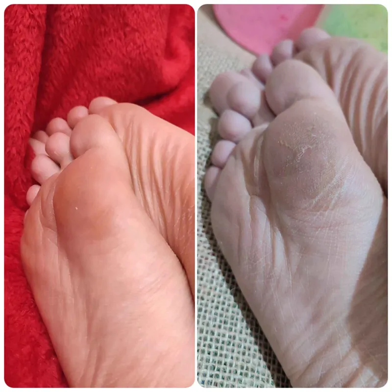 پدیکور کلاسیک 