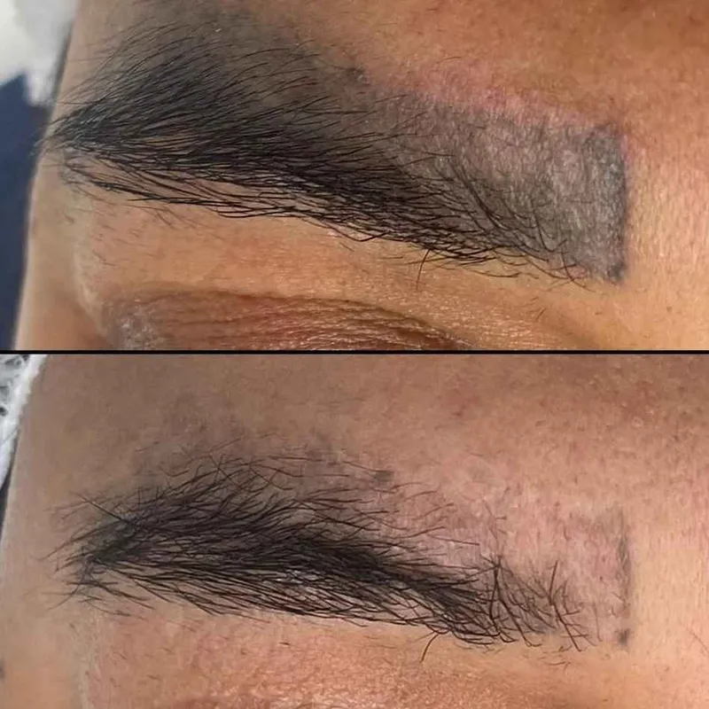 میکروبلیدینگ ابرو،میکروپیگمنتیشن، فیکانتور و شیدینگ لب،بن مژه ،خط مژه ،خط چشم ،،ریموو تخصصی ابرو اسیدی و قلیایی