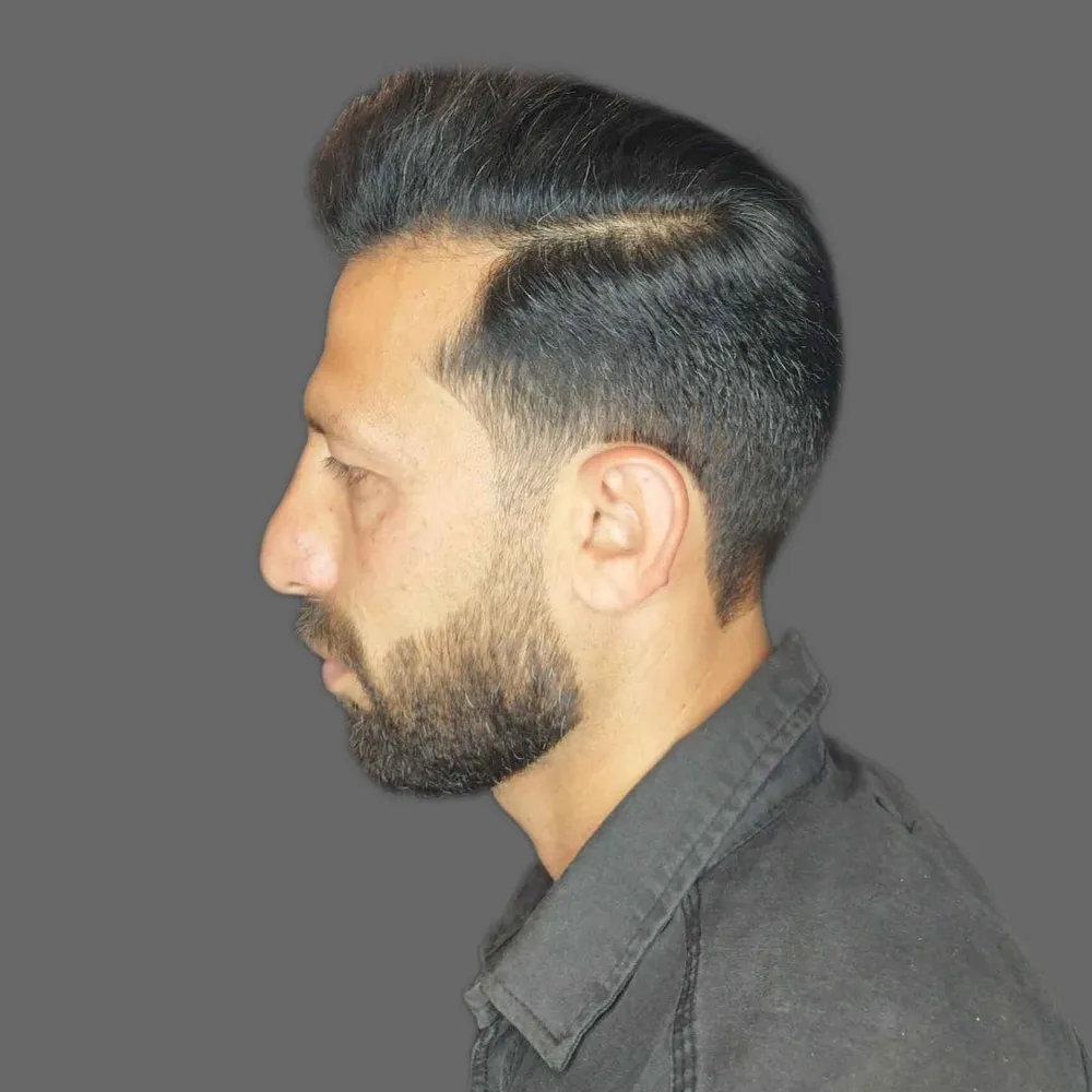 هیرکات وفید