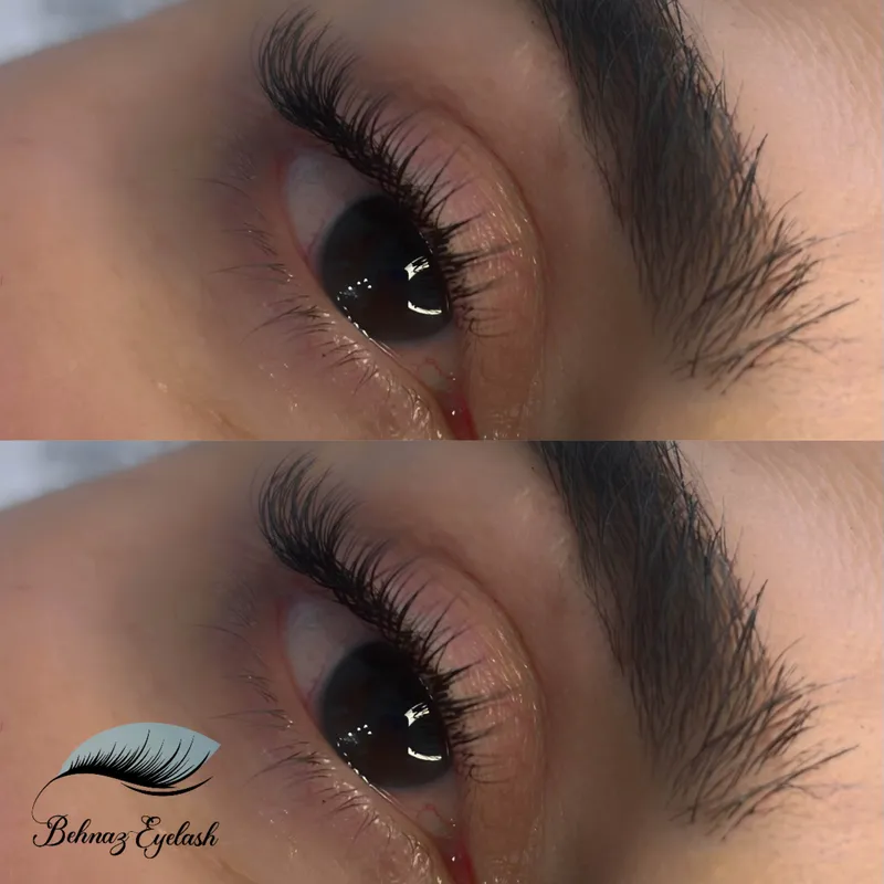 اکستنشن کلاسیک