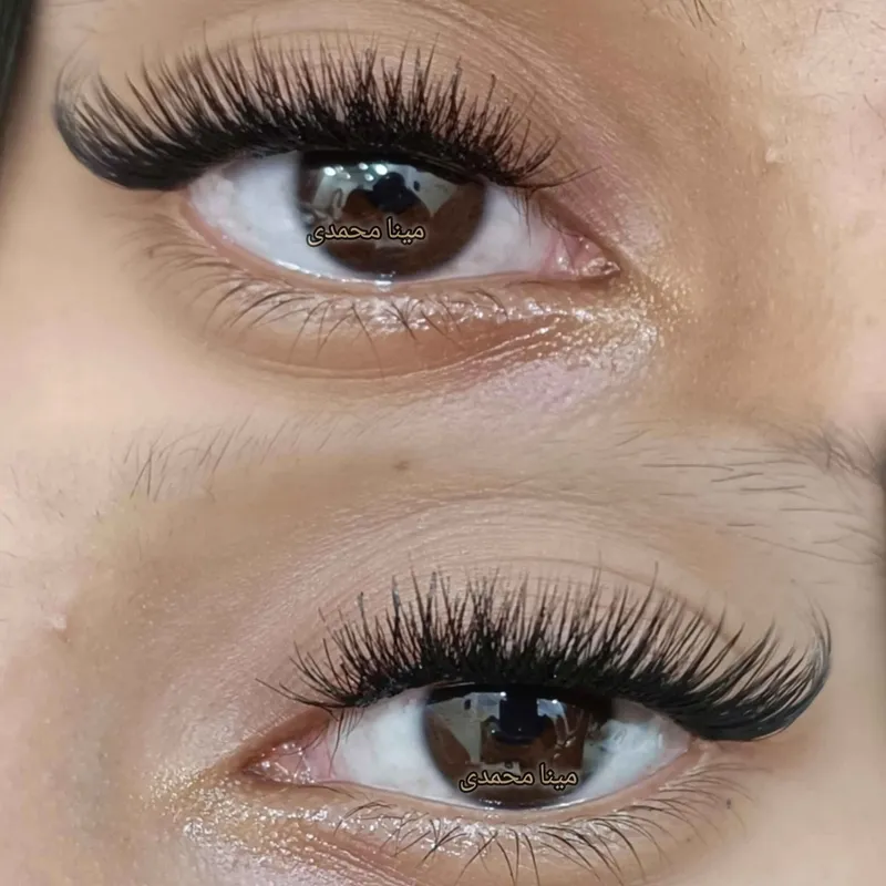 کاشت مژه هیدن 