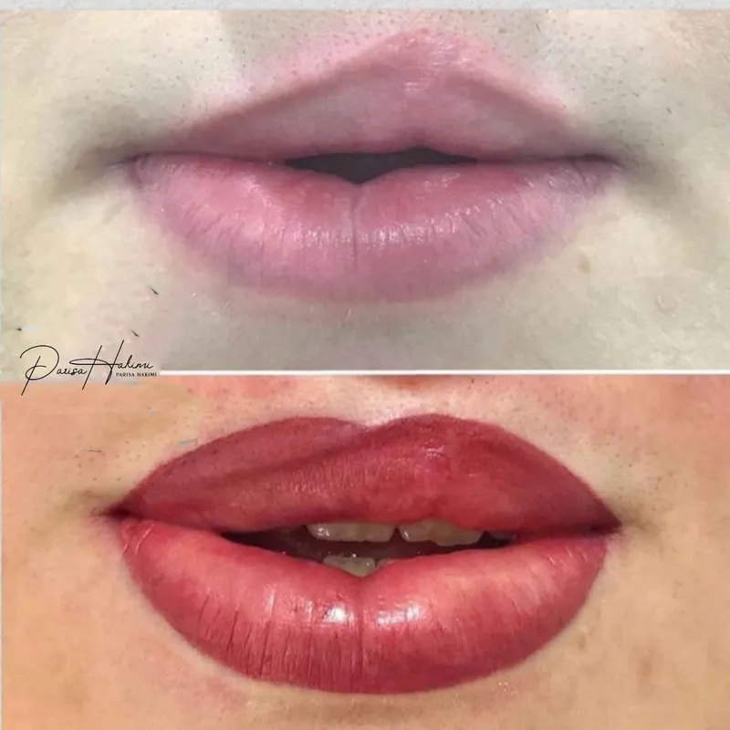 فیکانتور لب 