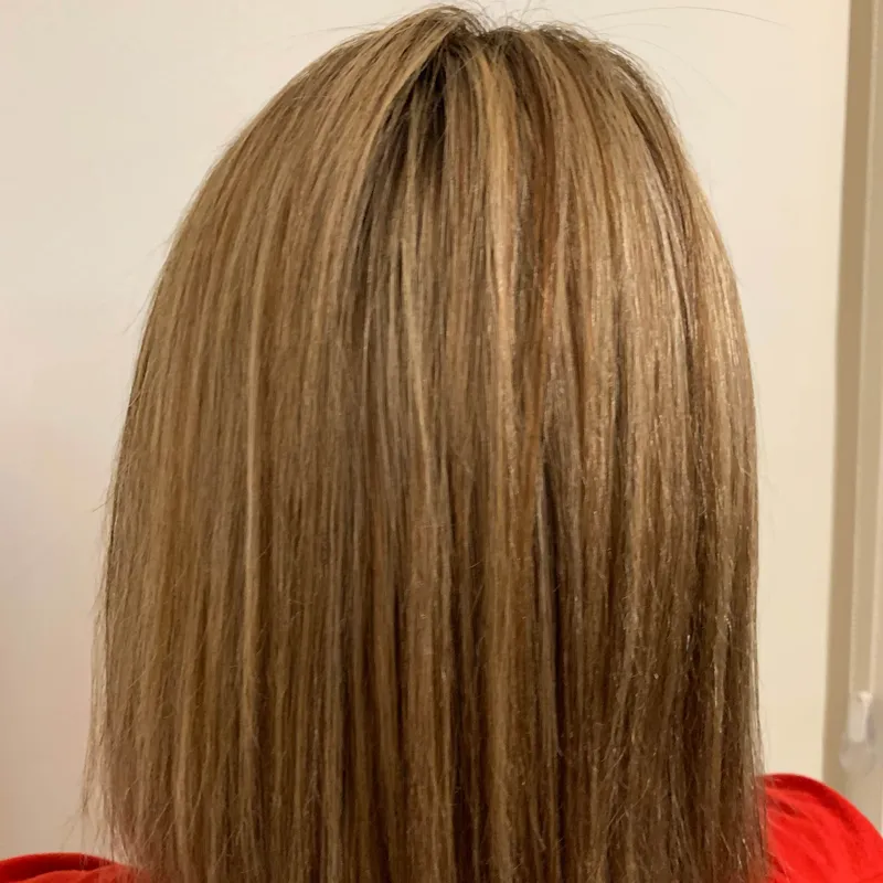 بوتاکس و احیا موی آسیب دیده