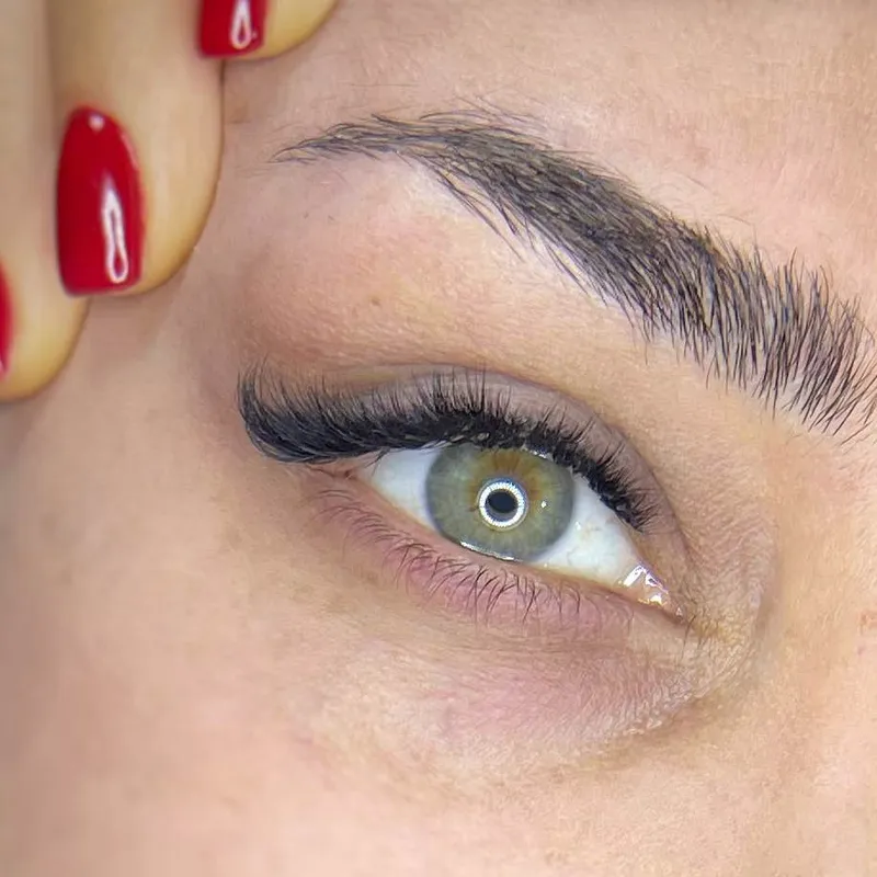 کاشت ۱۲۰۰ترمیم۱میلیون