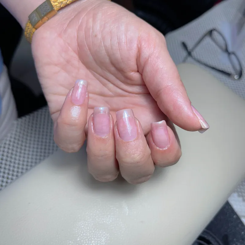 ترمیم لمینت