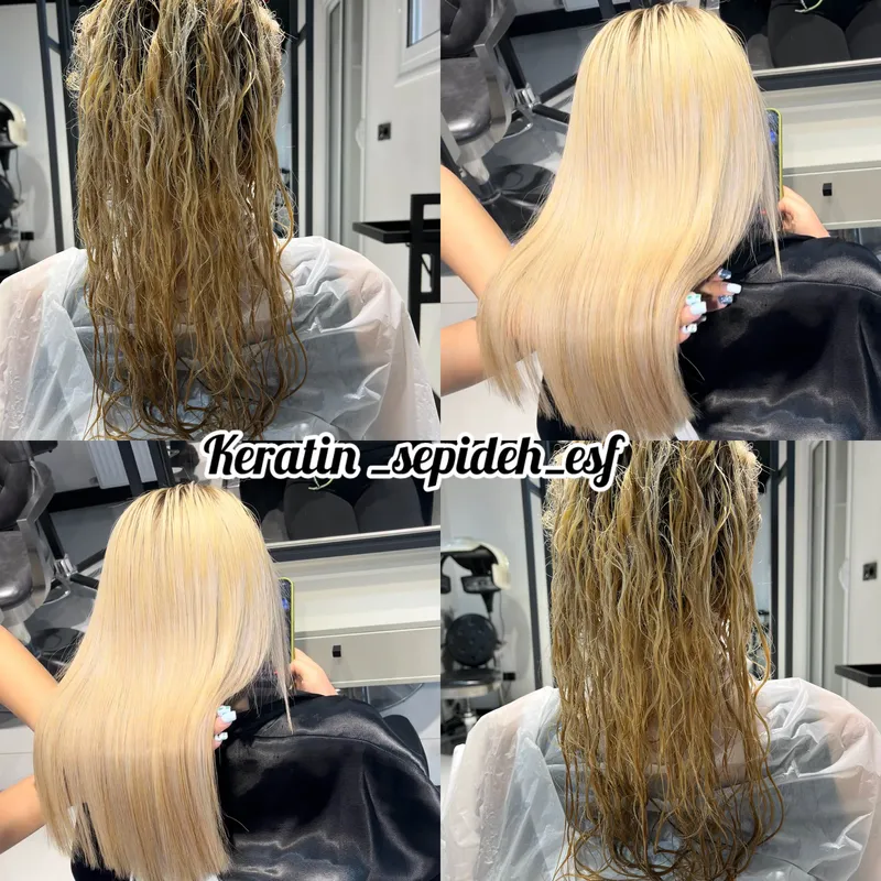 پروتئین تراپی