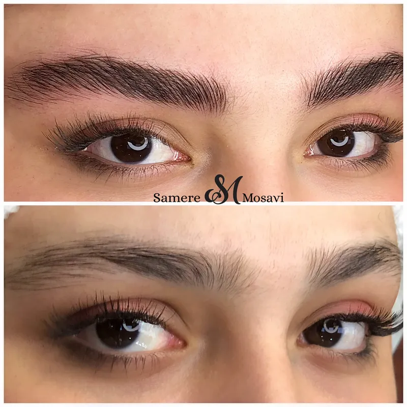 میکروبلیدینگ ابرو