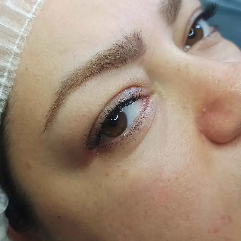 میکروبلیدینگ 