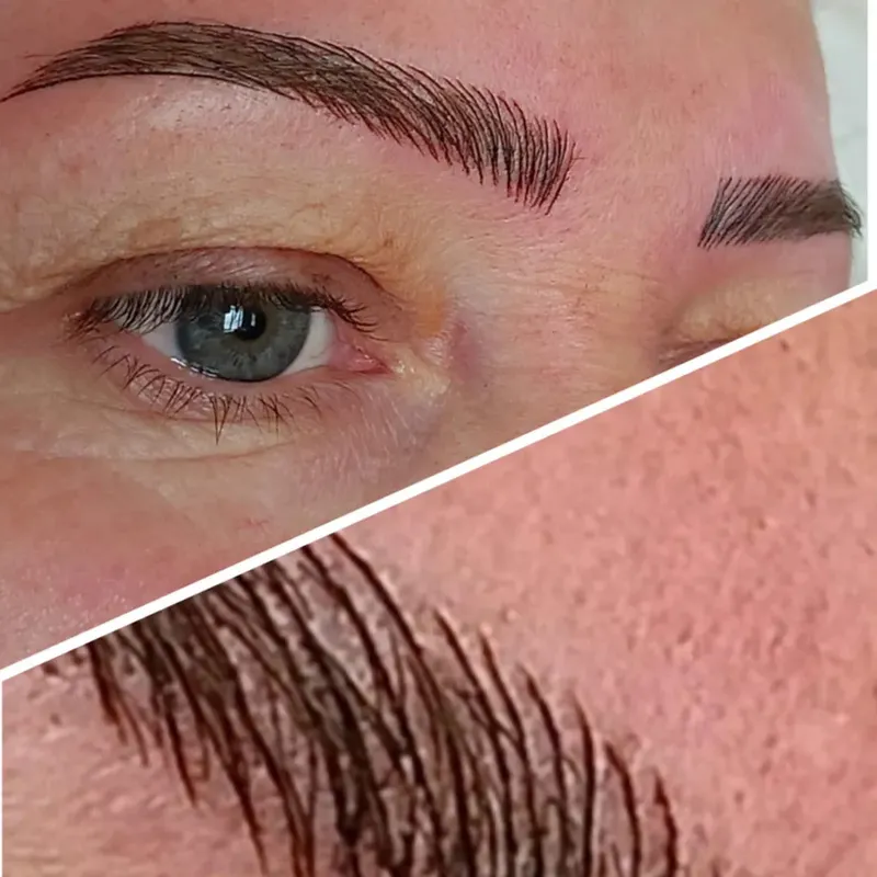 میکروبلیدینگ